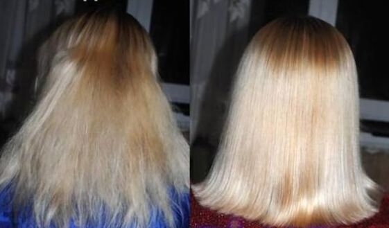 Prima e dopo il ripristino dei capelli